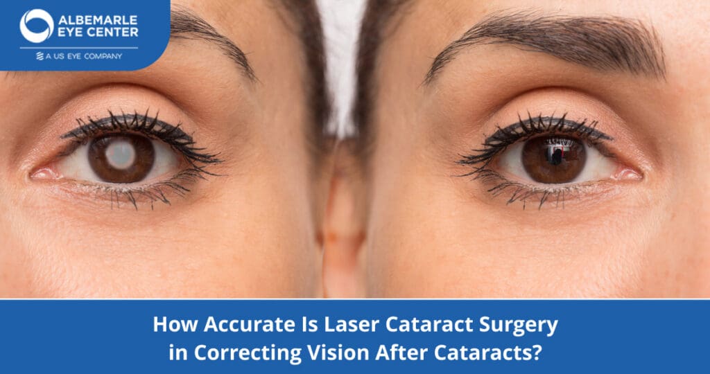 How Accurate Is Laser Cataract Surgery